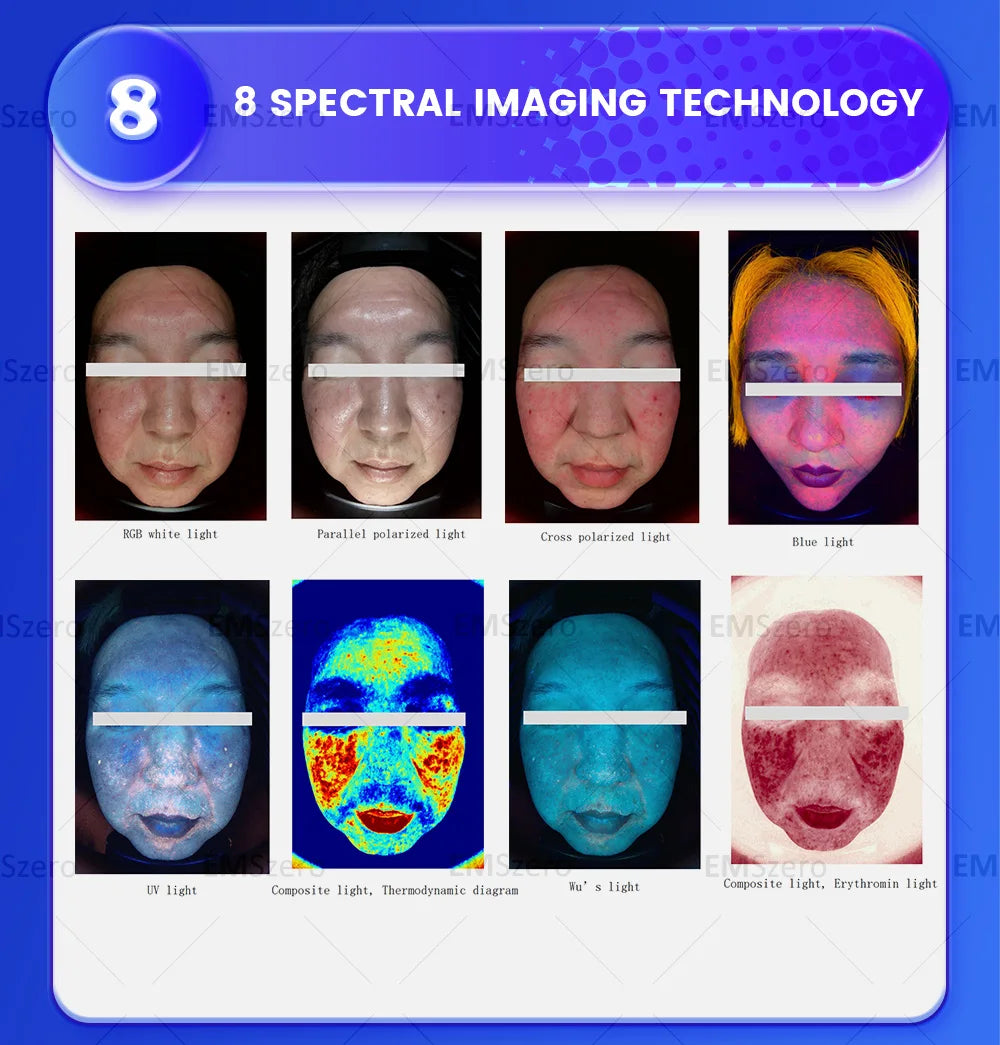Myoslim 3D Facial Skin Analyzer With Digital Scanner