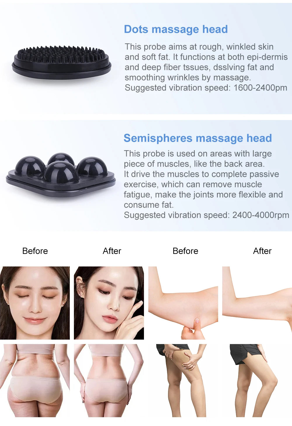 AOKO Vibrating Body Massage Machine For Slimming And Cellulite Care