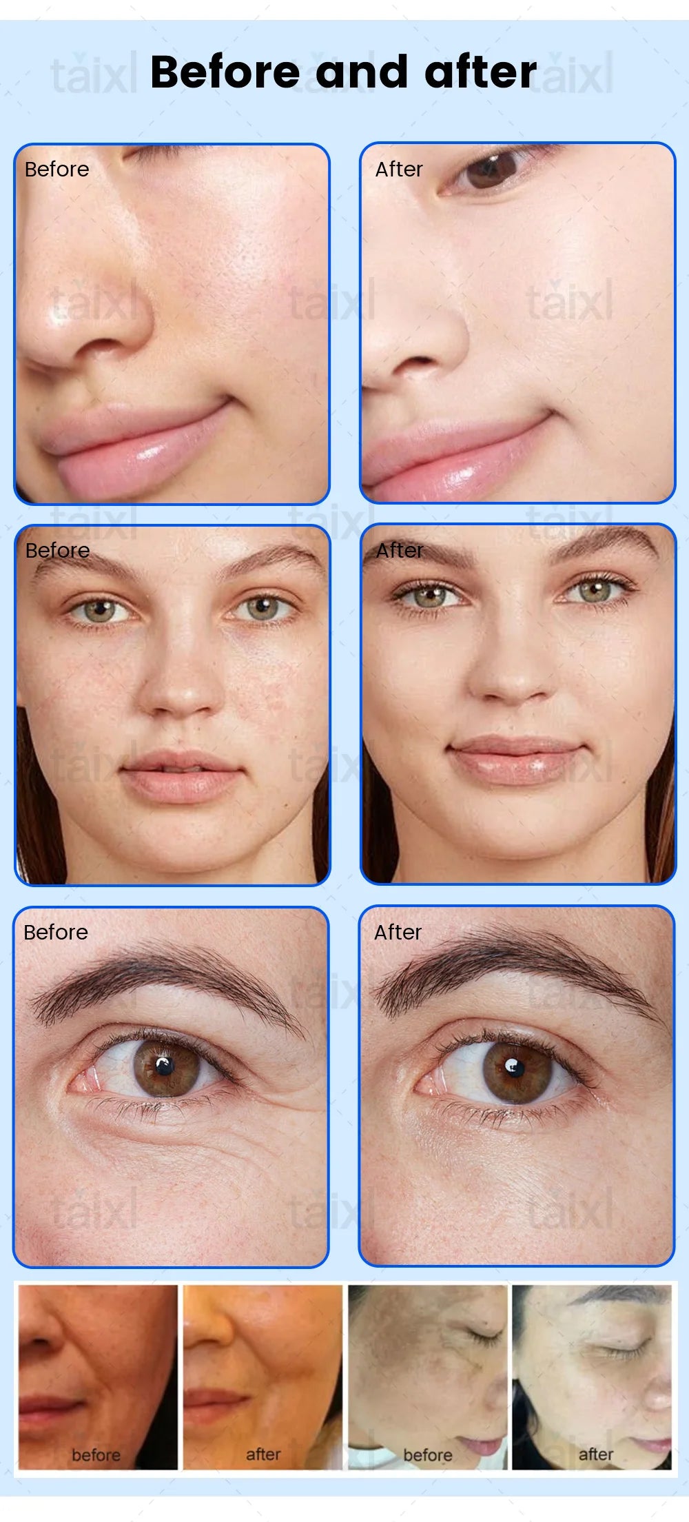 Cold Hot Plasma 8in1 Facial Machine Diamond Stamp Ozone Skin Rejuvenation Anti-Aging Acne Treatment RF Lifting Beauty Equipment