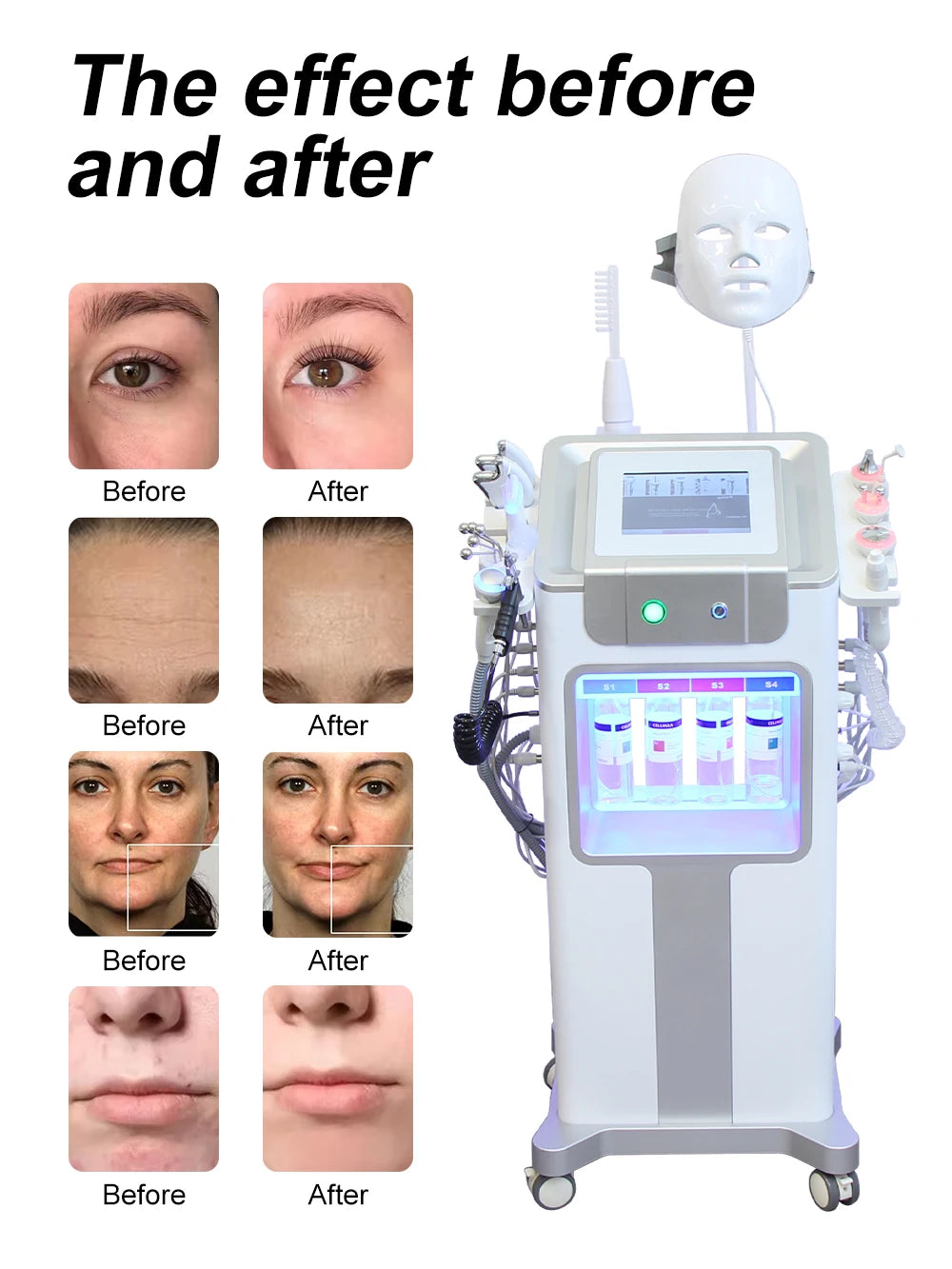 AOKO 12 In 1 Aqua Peeling Oxygen Facial Machine Skincare