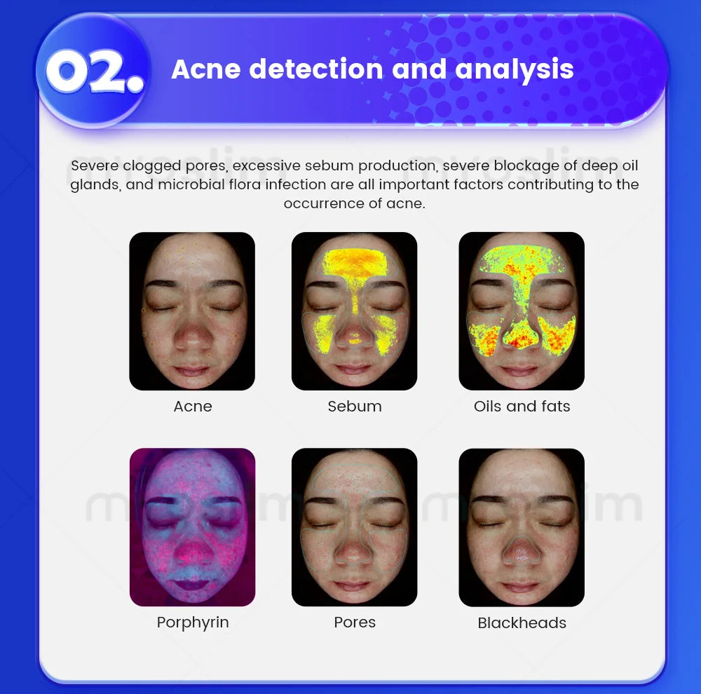 MYOSLIM 3D Pro Facial Scanner X5Pro Camera UV Skin Analysis