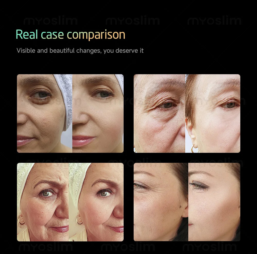 360MAX 25D HIFU 3 In 1 Non Invasive Beauty Equipment New Design Anti Aging Body Slimming Skin Firming Professional Salon Machine