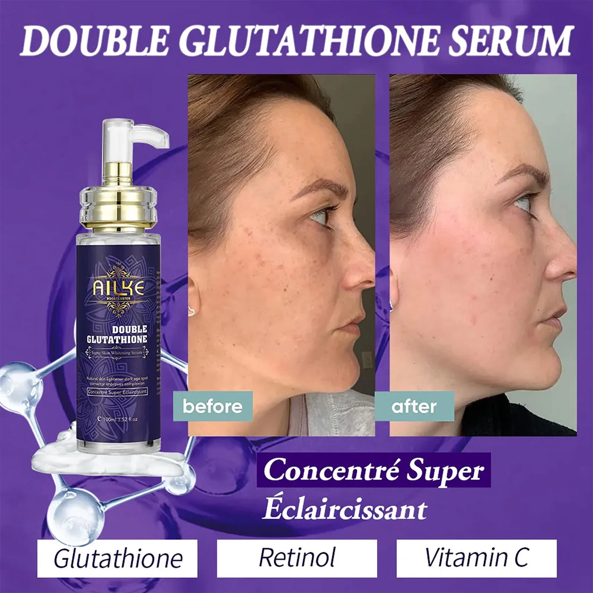 Ailke Double Glutathione Whitening Serum For Dark Spots