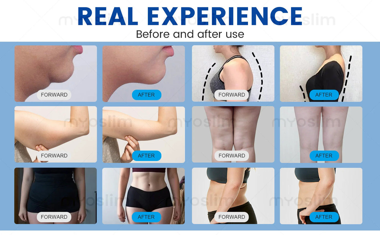 MYOSLIM Multi-Function Body Shaping Device With 8 Silicone Heads Ultrasonic