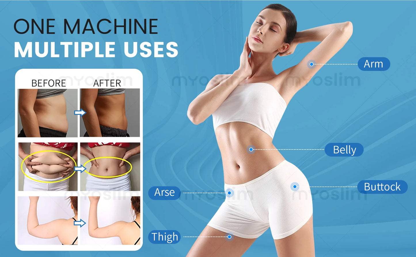 MYOSLIM High-Intensity EMS Sculpting Device For Body Contouring