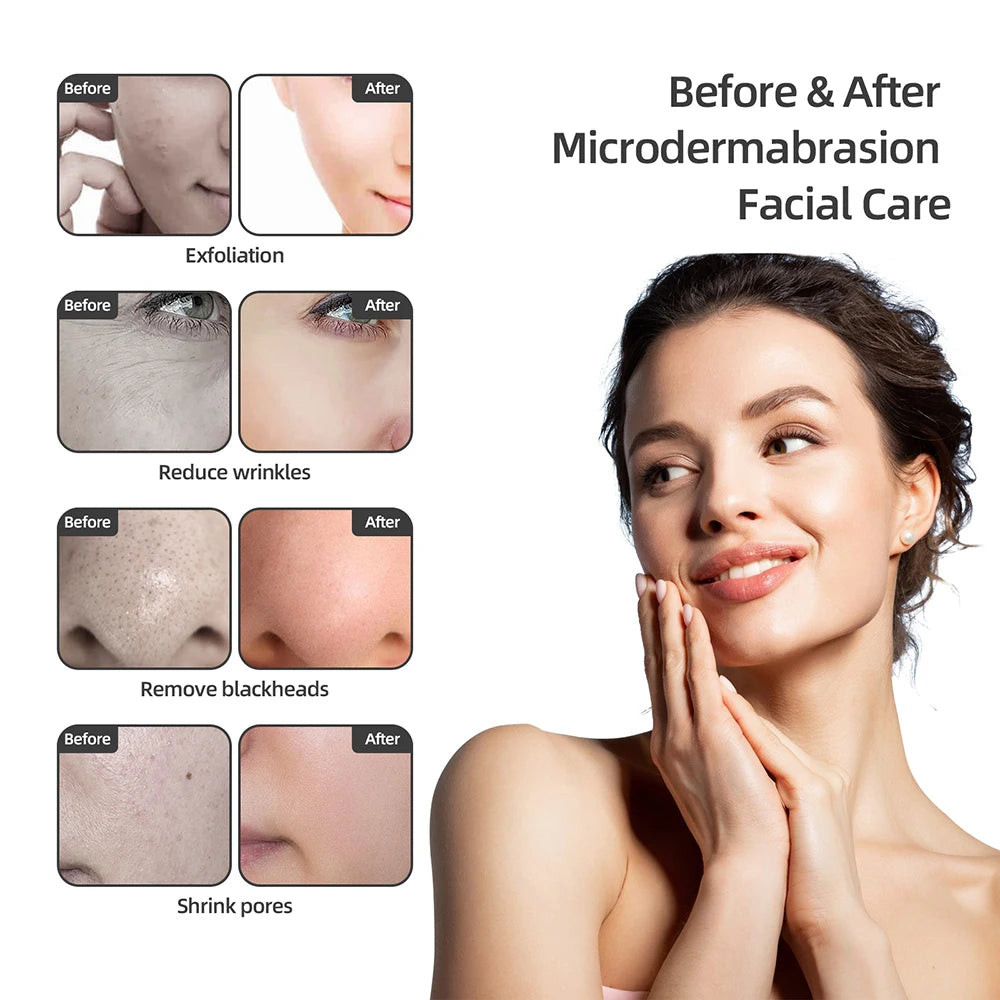 Professional Diamond Microdermabrasion Machine Water Spray Exfoliation Face Peeling Beauty Machine Pore Deep Cleaning Skin Care