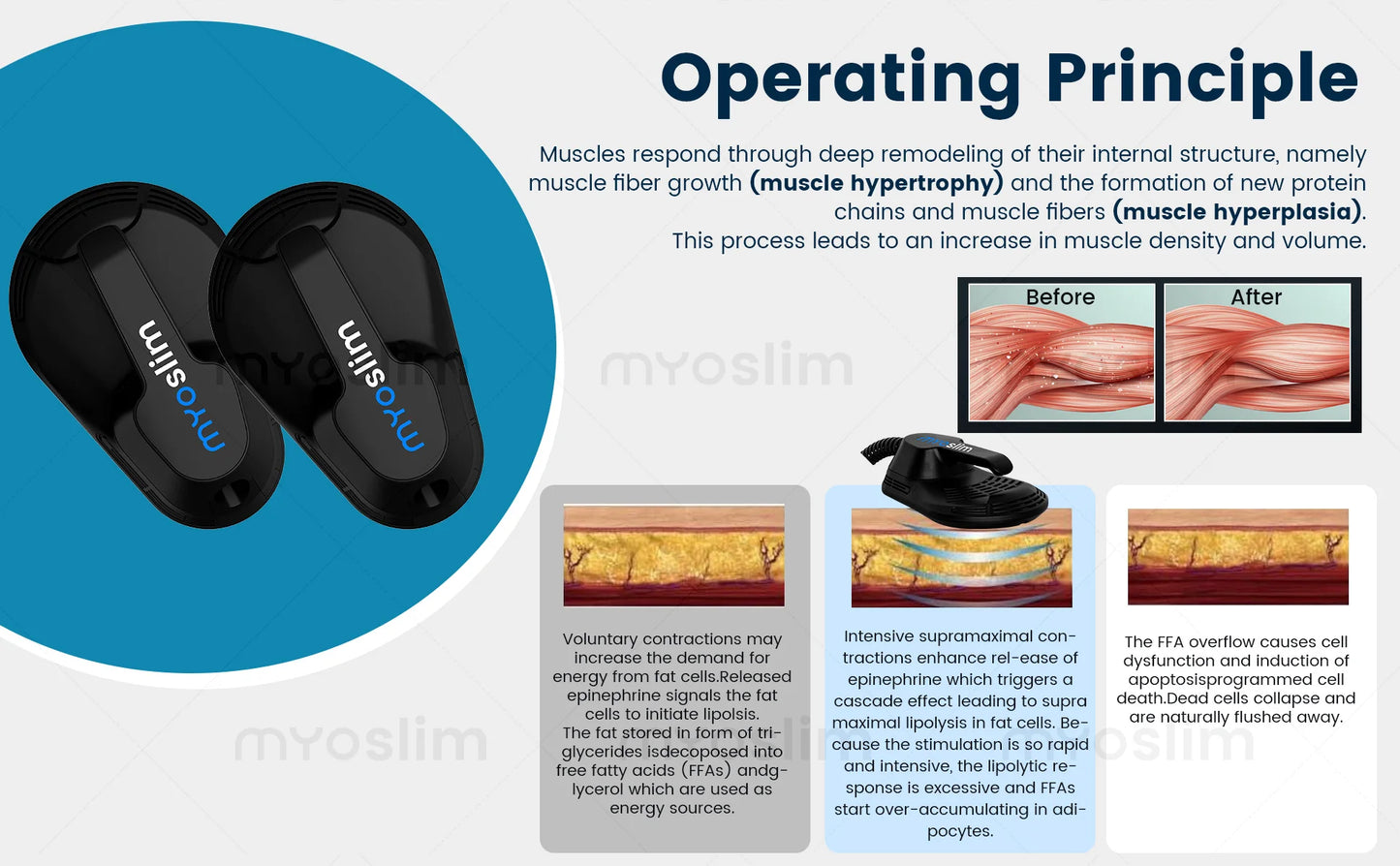 MYOSLIM High-Intensity EMS Sculpting Device For Body Contouring